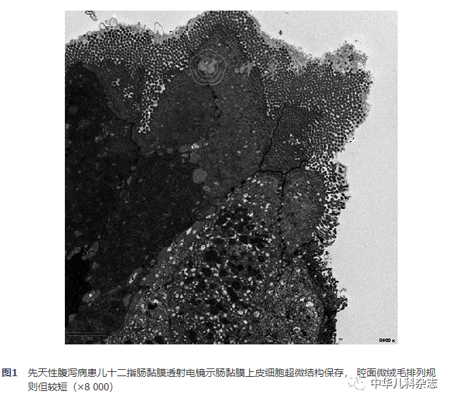 什么是基因缺陷症 7595ccd5fa0546b2bd0835f68f1ac23f.png
