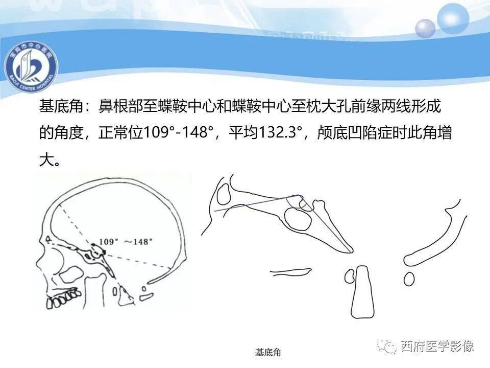 面颊不对称,颈项粗短,后发际低,颈部活动受限且固定于特殊的角度位置