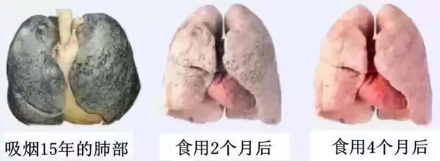 每天一块,再也不怕雾霾二手烟_肺部