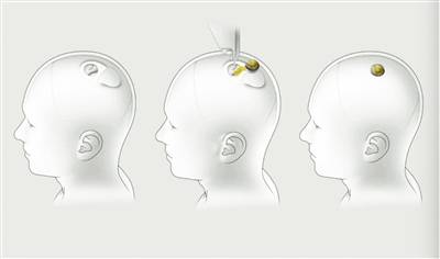 病毒|2020年国际十大科技新闻解读