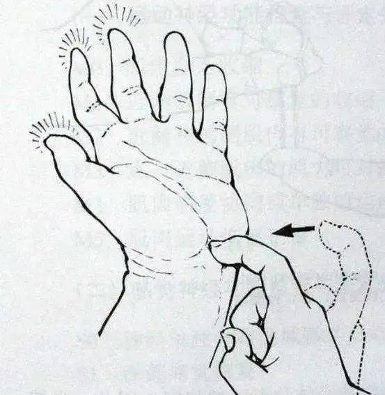 一文说清l手部麻木的7种常见病因,如何鉴别及治疗