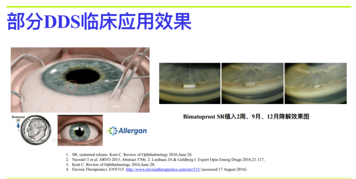 70f5b0eef5fb414bac7f1400a815c56b.png