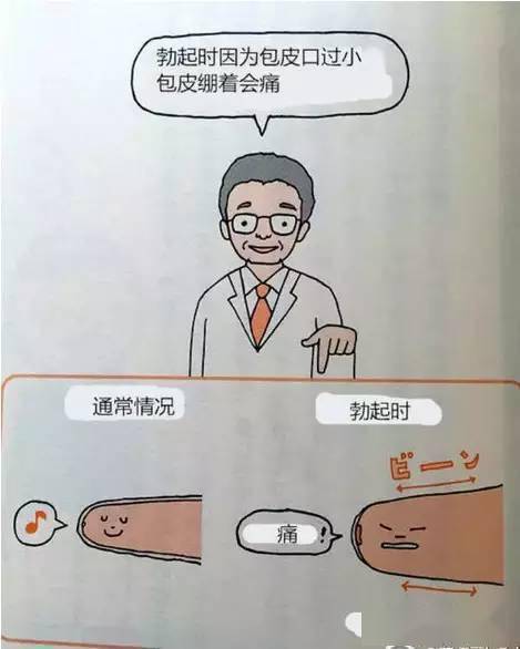 孩子割包皮这件事影响很严重家长必看