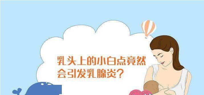 乳头上长小白点,还反反复复?这样处理很管用!