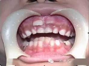 从现在开始为孩子找儿童牙医检查,做出适合孩子生长的家庭管理方案吧