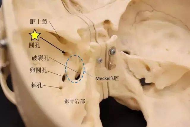 三叉神经解剖及功能