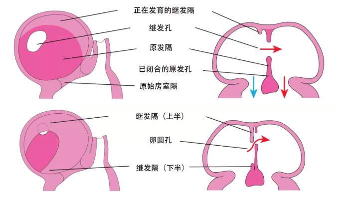 新手福利房间隔缺损的超声诊断及治疗