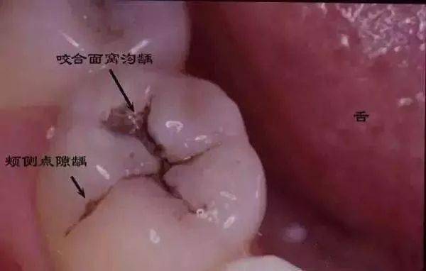 你的牙危险了!