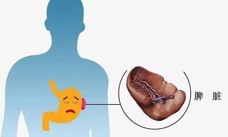 2fb769af163a4fa1b03e3fdc3493fdd8.jpeg
