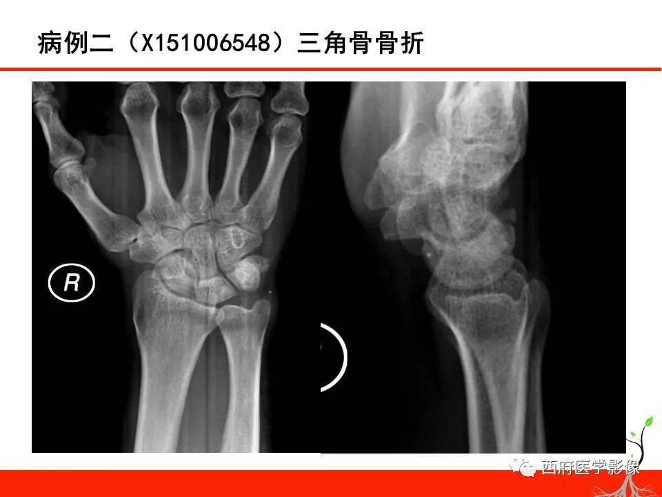 本平台属公益学习平台,转载系出于传递更多学习信息之目的,如有图片