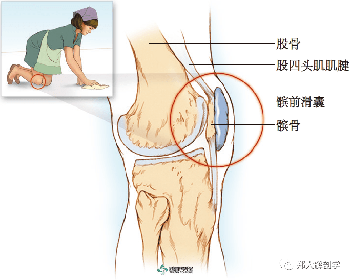 膝部的x线平片检查能发现囊腔和相关结构的钙化,包括股四头肌肌腱符合