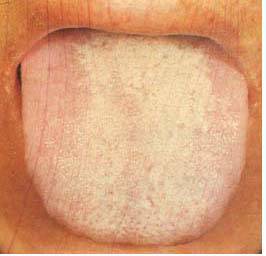 教你判断,一秒就会._舌苔