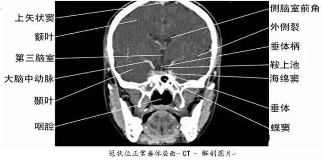 珍藏版 | 全身ct图谱!