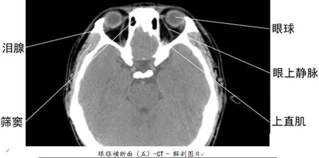 珍藏版全身ct图谱