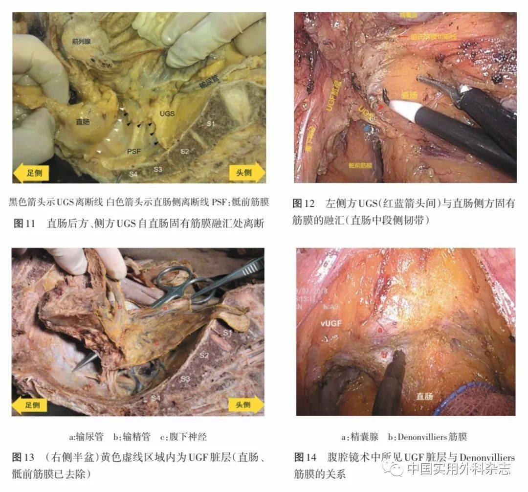 论著|男性泌尿生殖层的层面解剖及其临床意义研究_结构