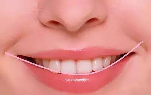 牙齿排列要整齐,无龅牙,兜齿等牙齿畸形现象;牙色干净白皙,无污垢,齿