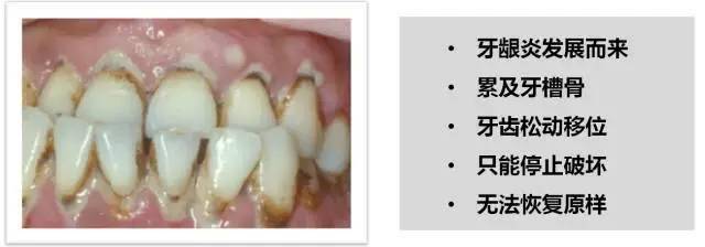 牙龈不健康的几大表现,你中招了吗?