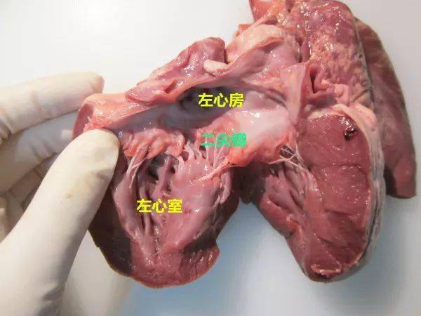 身为一名法医我来实际解剖一颗心脏