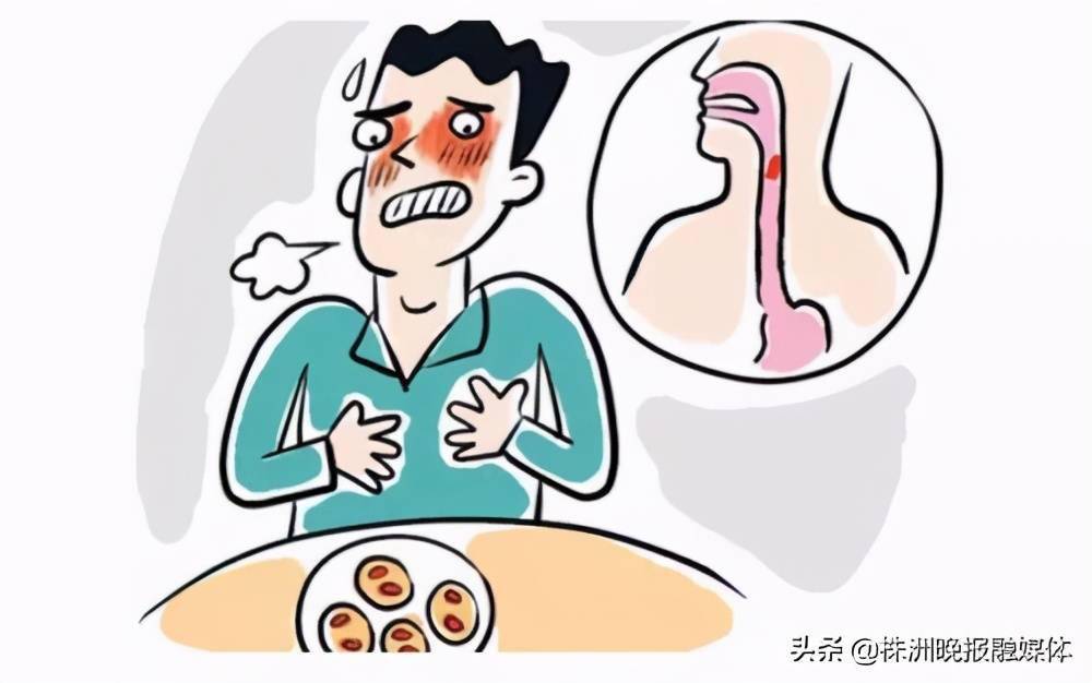 春节来临,异物卡喉高发,这些急救方法一定要看看
