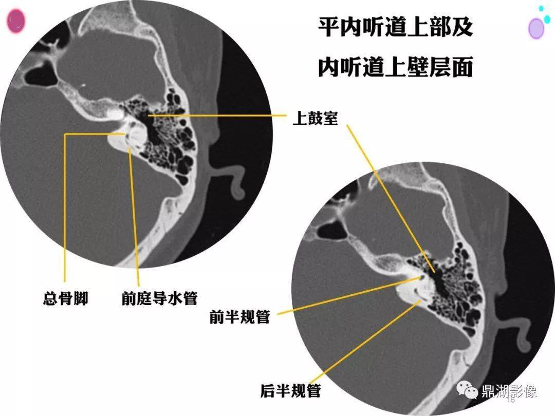 收藏史上最全的ct断层解剖图谱一篇所有都有