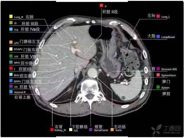 收藏史上最全的ct断层解剖图谱一篇所有都有