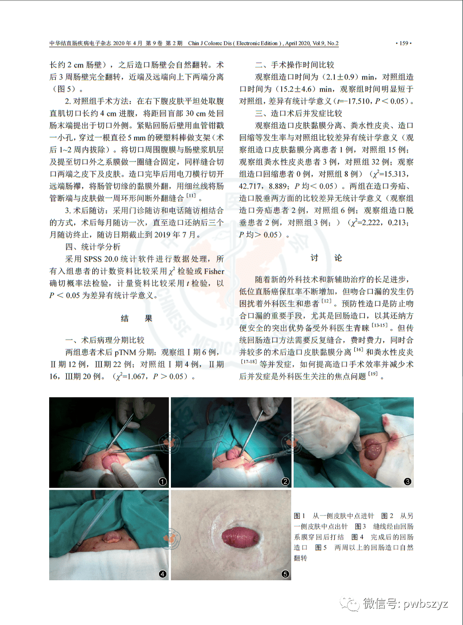 《基于一针法预防性回肠造口在后期肠造口还纳术中的技术优势》也已经