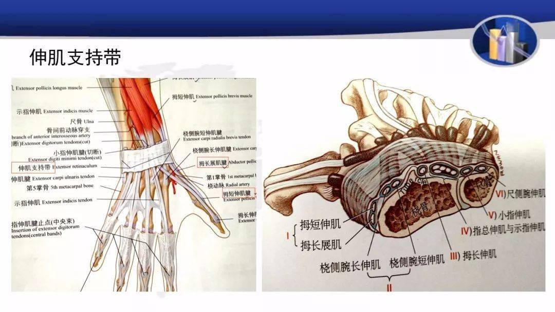 骨沟与腕背韧带构成了骨性纤维管,拇长展肌与拇短伸肌肌腱共用一个