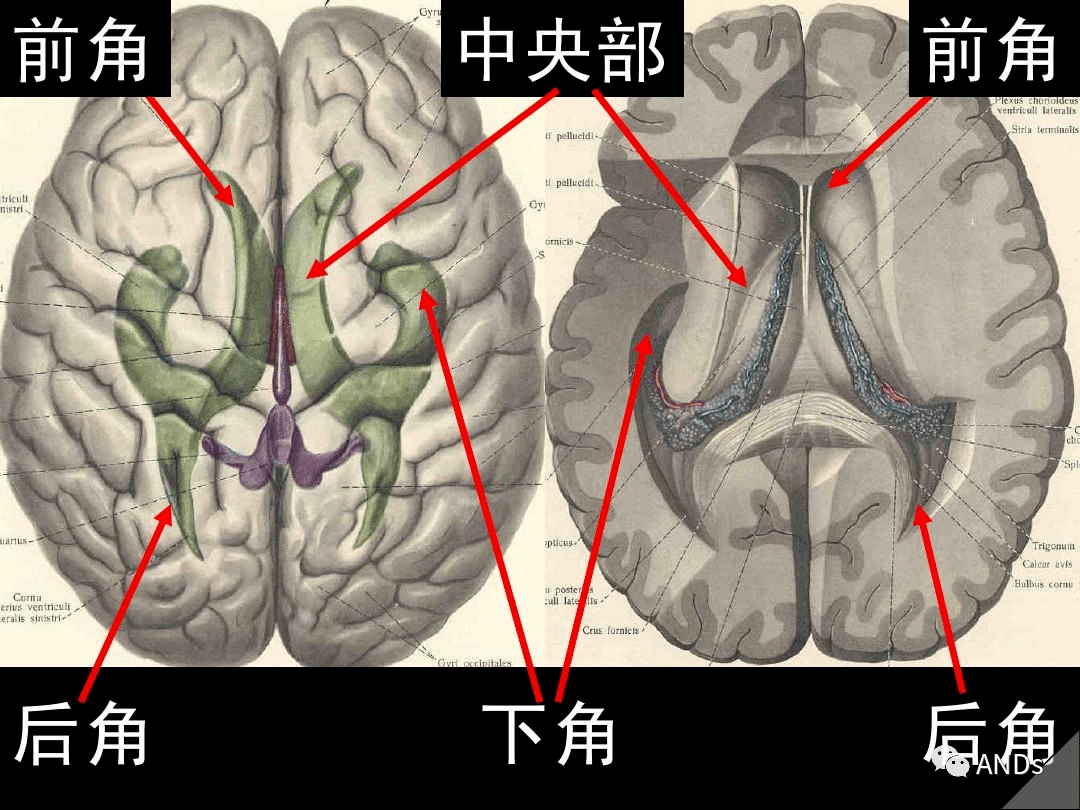 高清解剖:脑室/脑池/脑膜