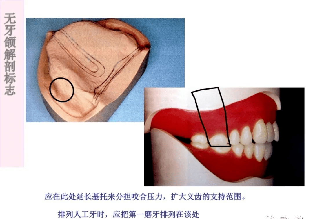 【干货】无牙颌解剖标志