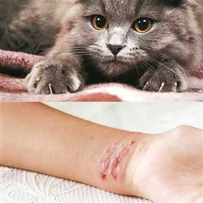 宁波有人不幸"中彩",医生提醒:如被宠物抓伤,咬伤一定要及时清理伤口