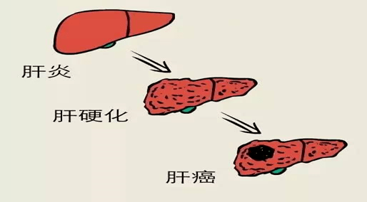 抓住肝脏病变的信号