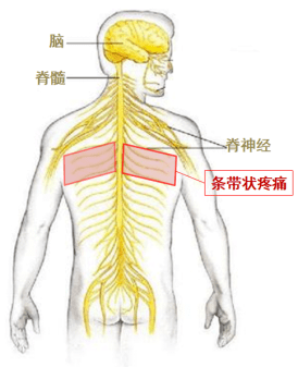 如果胸背部有条带状的疼痛,而且平躺时疼痛更加明显,一定要来医院检查