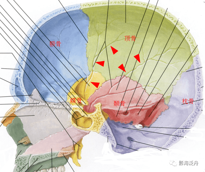 颅骨内面观:注意图中标注的血管压迹(脑膜中动脉)与各个颅缝的关系.