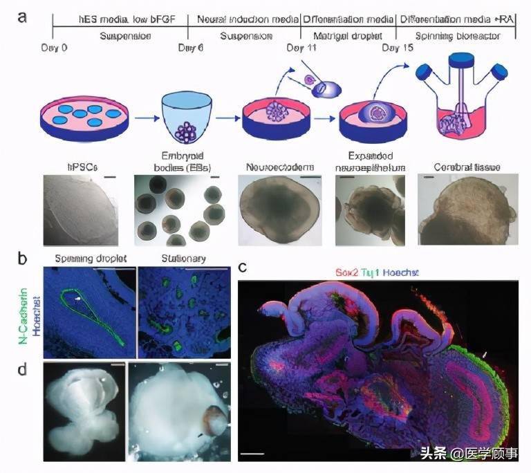 脑类器官培养系统cerebral organoids model human brain development