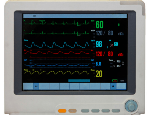 监护仪常规监护项目包括:心电图,心率,血压,血氧饱和度,呼吸频率,中心