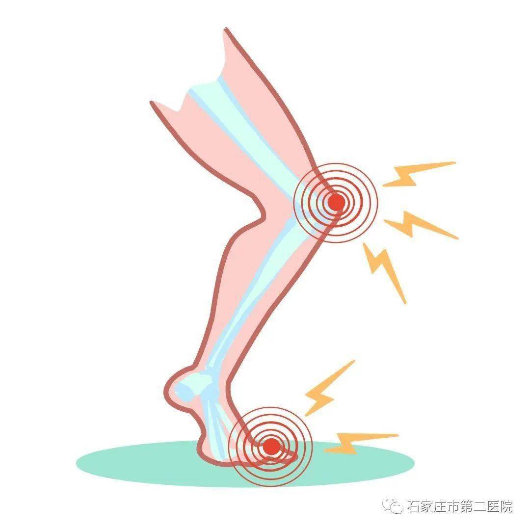 【关节疾病科普园】糖尿病会引起这种关节病!