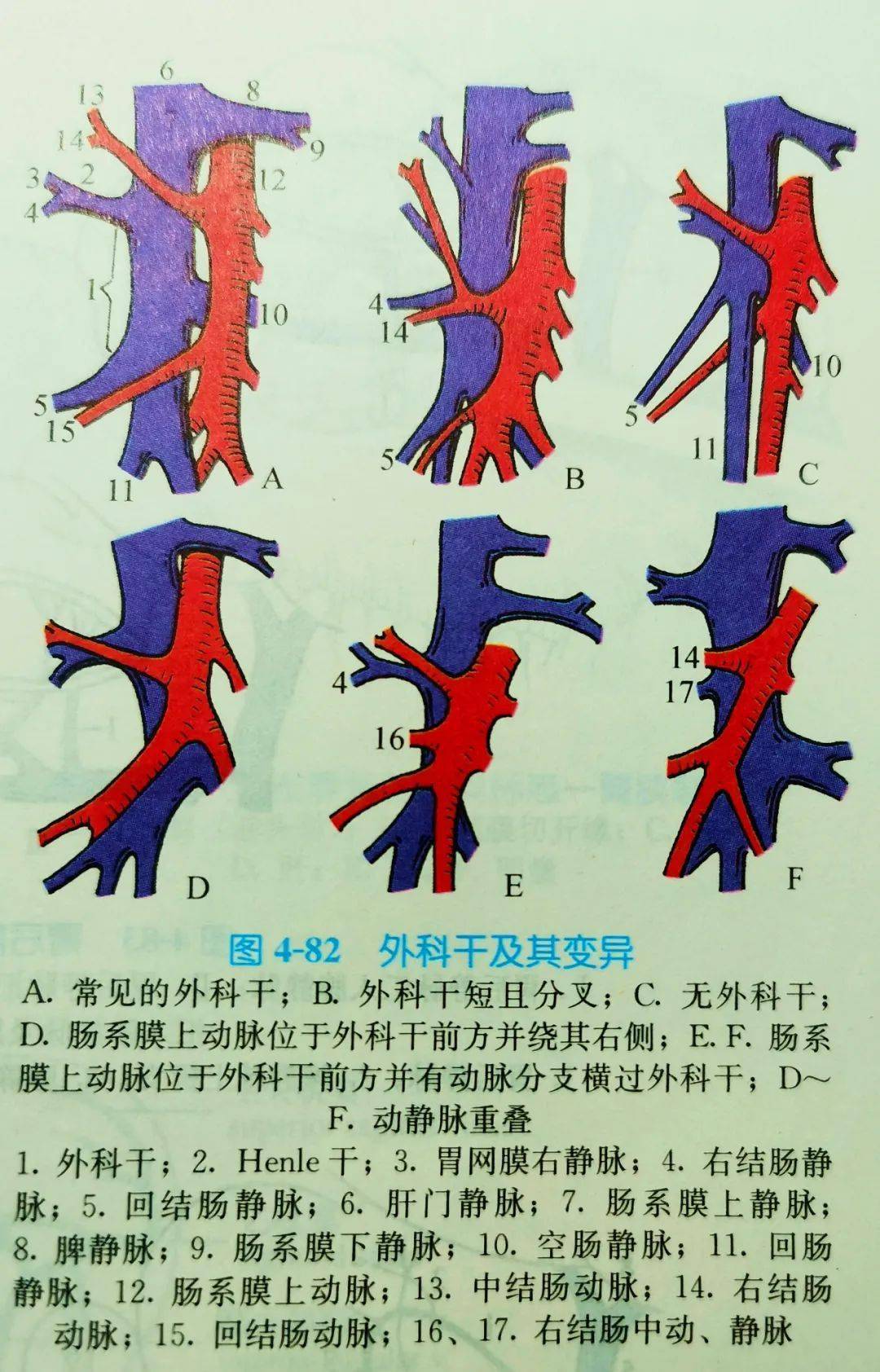 图(10):外科干及其变异(《局部解剖学》)↑↑↑9,胃网膜右动脉(right