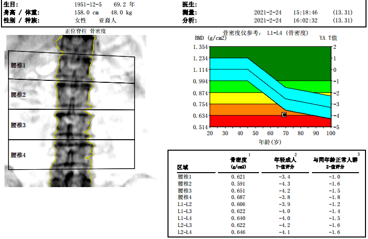 袁大姐双能x线吸收法骨密度报告