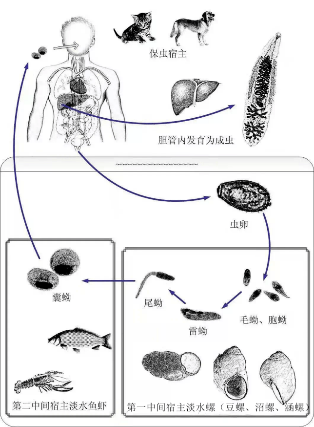 罗润齐主任医师表示,上文的患者小何还患有猪囊尾蚴,裂头蚴,包虫