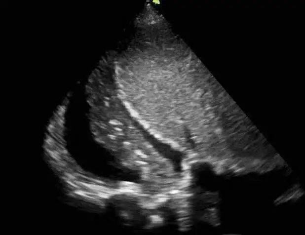 icu的忠实守护者,飞依诺重症超声全解析(一)