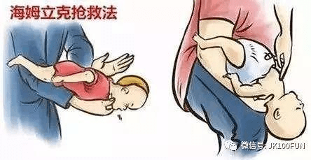 将婴儿翻转成俯卧位,使其头低于躯干,同时用手握住双下颌以托住头,并