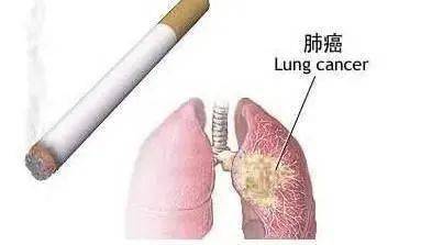 吸烟会对心血管系统造成严重影响,冠心病致死病例中有35%可直接归因于