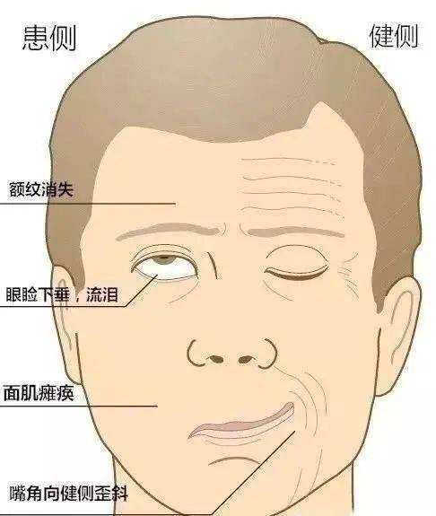 颞骨骨折手术等;肿瘤包括中耳瘤,听神经瘤等;畸形包括先天性耳畸形可