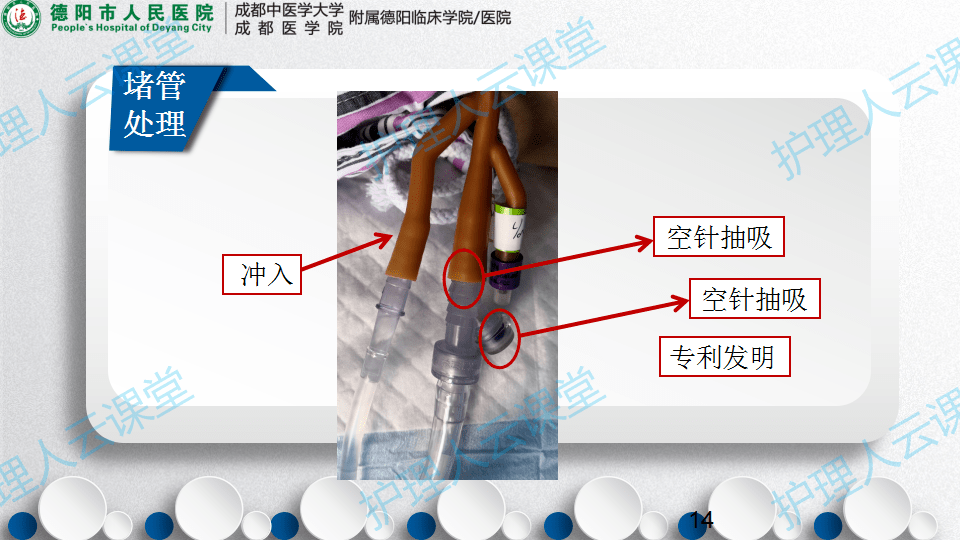 密闭式三腔尿管膀胱冲洗术