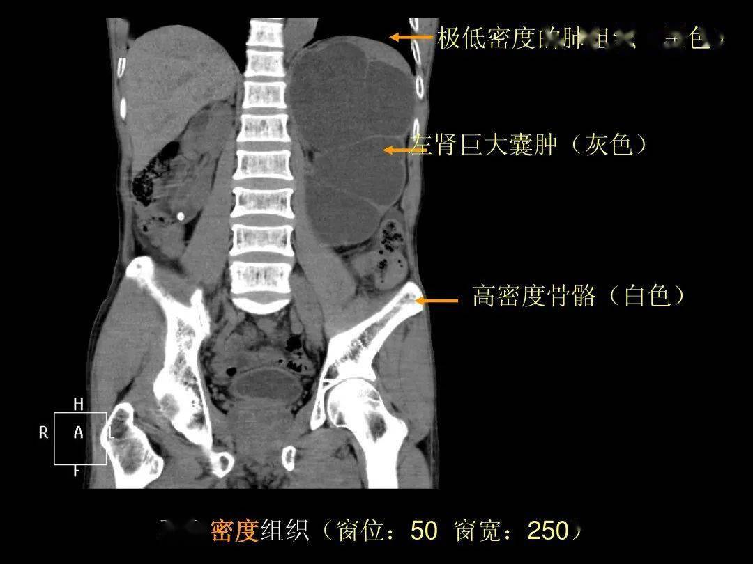 超细的腹部ct应用入门必备手册(原理 精美解剖图谱)