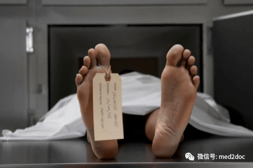 匪夷所思!一名男子接连被3名医生宣告死亡,却在尸体解剖前突然复活