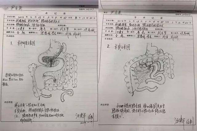 超赞手绘"手术图谱"!六旬老院长圈粉无数