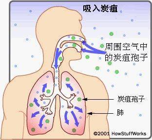科普丨炭疽病知多少?