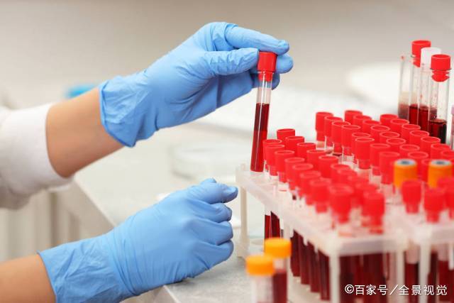 严重|明明血肌酐还好,可肾病已处于严重阶段,怎么回事?