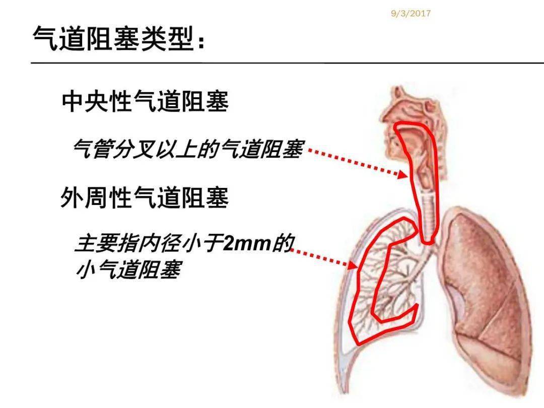 异物卡在喉咙